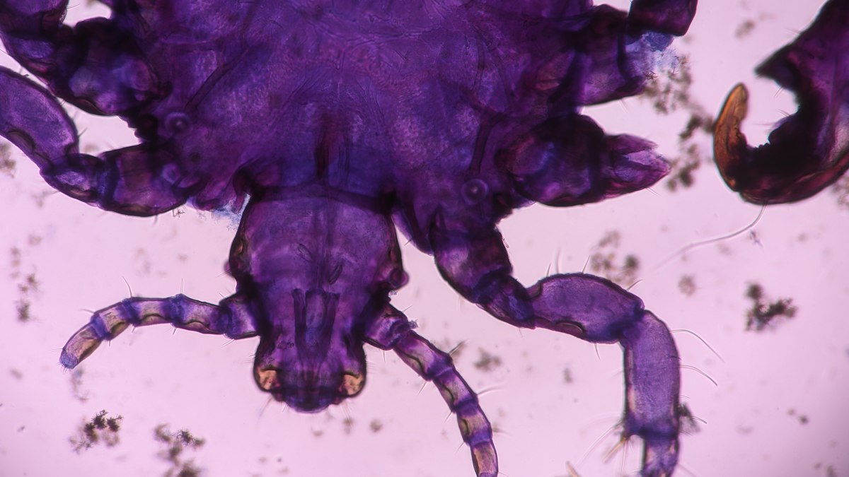 Parasit Giardia